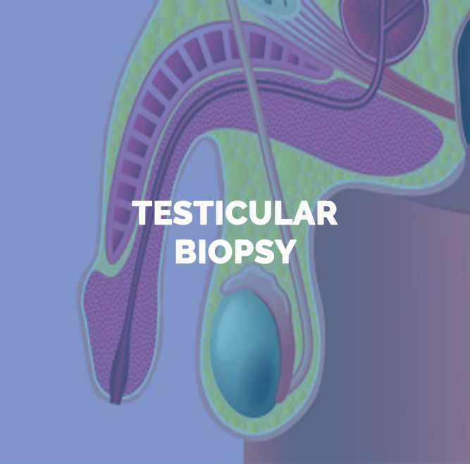 tratamiento biopsia testicular